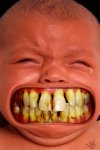 Baby Teeth.jpg